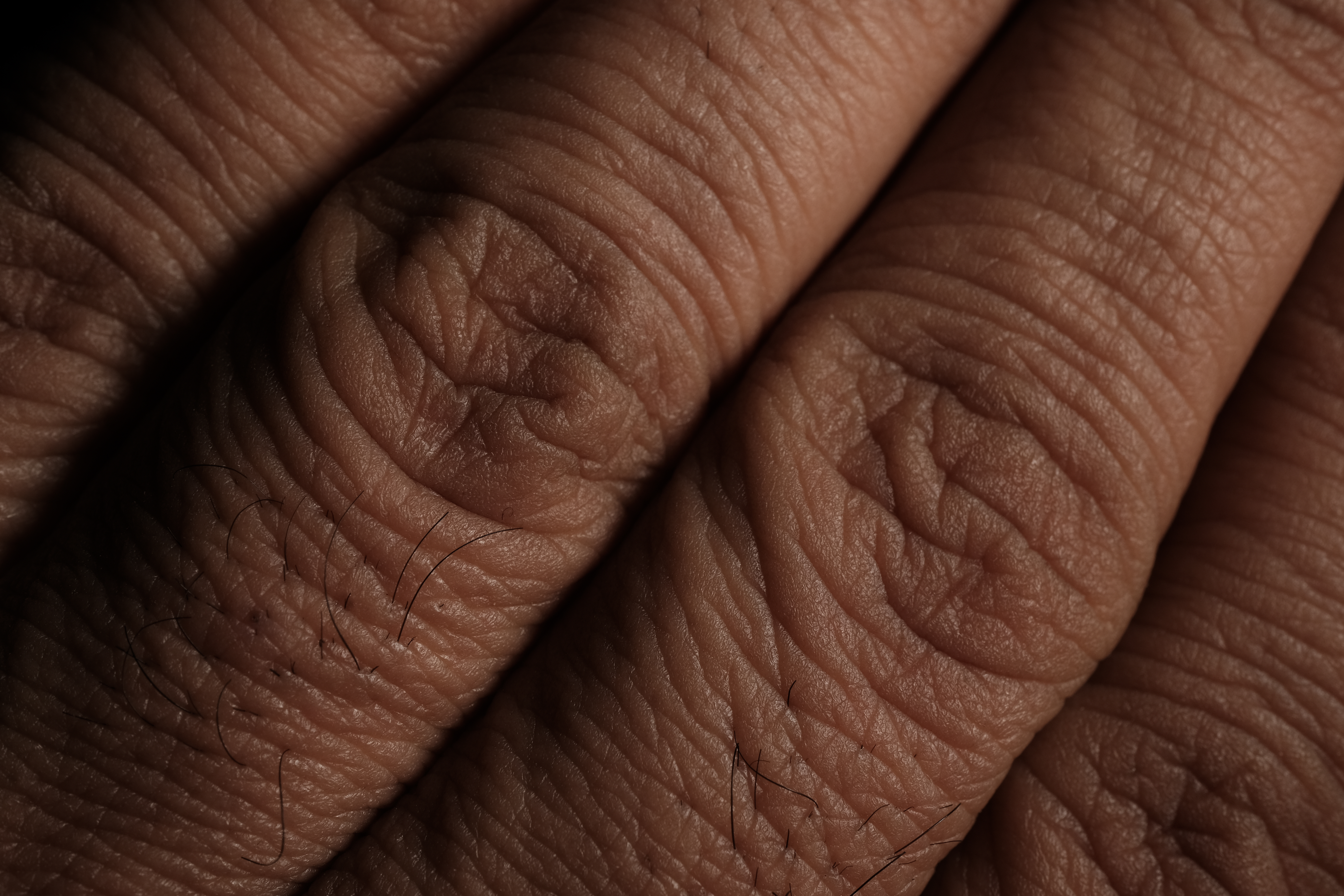 Gut Health and Eczema: What the Connection Really Means for Your Skin