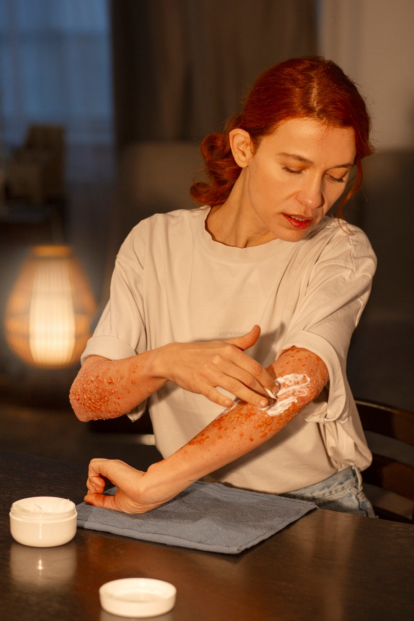 Why Eczema Keeps Coming Back: Triggers, the Gut–Skin Connection, and Holistic Habits That Help